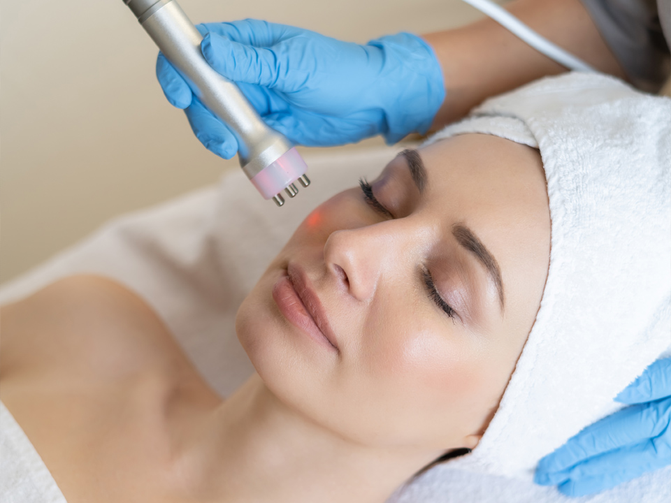 RADIOFRECUENCIA <br>FACIAL